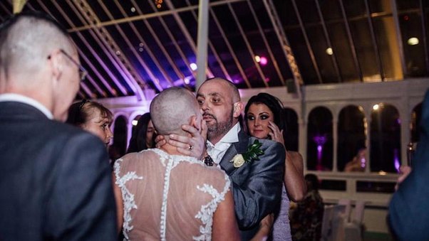 Gəlin toy günü saçını keçəl etdirdi, bəy ağladı