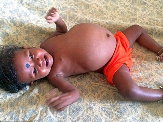 15 aylıq qızın qarnından çıxan şok yaratdı