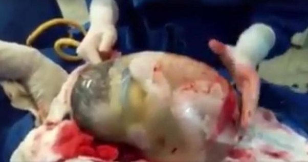 Doğuş zamanı inanılmaz hadisə