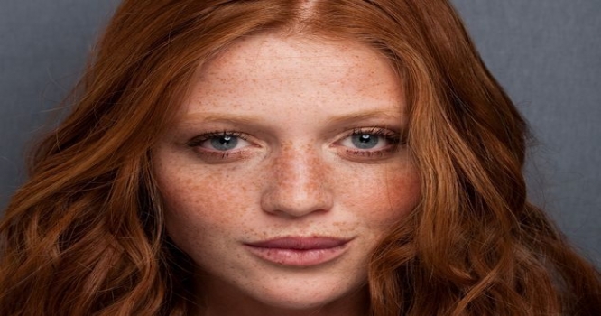 Üzdəki çilləri təbii üsulla necə yox edə bilərik?