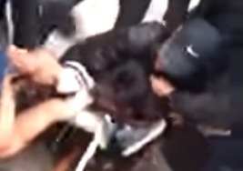 İt şəhərin mərkəzində qəfil uşağa hücum çəkdi