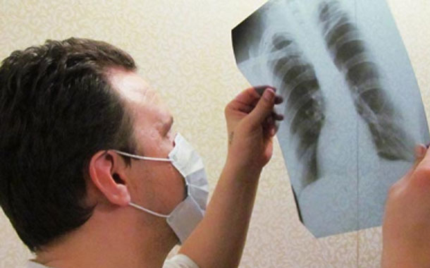 Siqaret haqda daha bir təhlükəli fakt