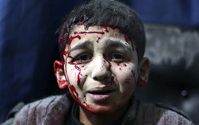 Suriyalı uşaqların fotosuna görə qalib oldu