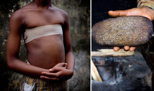 Genç kızları tecavüzden korumak için göğüslerine…