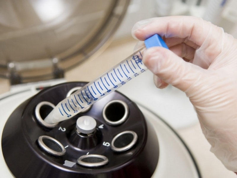 Alimlər süni sperma yetişdiriblər