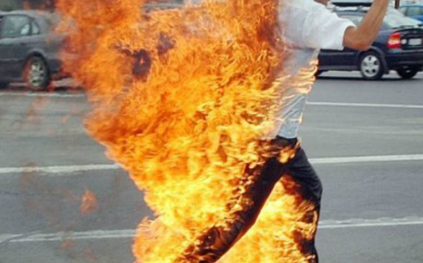 Bakıda özünü yandıran şəxs öldü