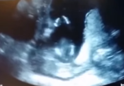 ANA BƏTNİNDƏ ƏL ÇALAN KÖRPƏ ŞOKA SALDI