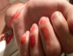 Bakıda qadın damarlarını doğradı