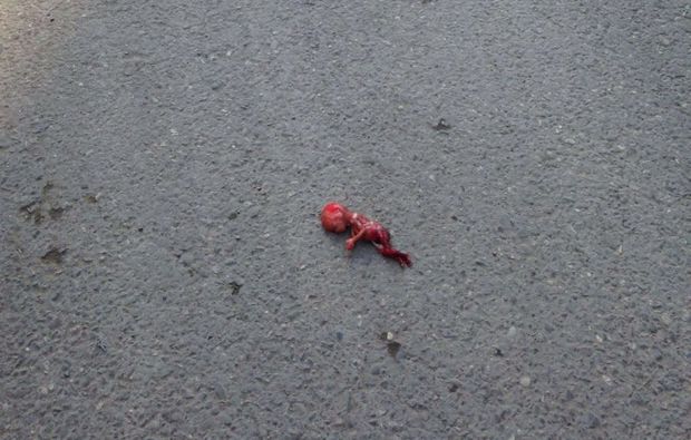 Bakda abort qalıqları yolun ortasına düşdü