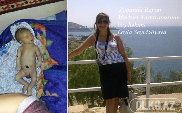 Zaqatala Mərkəzi Xəstaxanasının baş həkimi uşağımı pula görə öldürdü