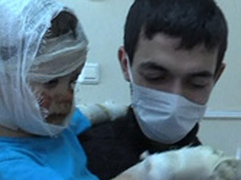 Yandırılan azərbaycanlı uşaqdan xəbər var