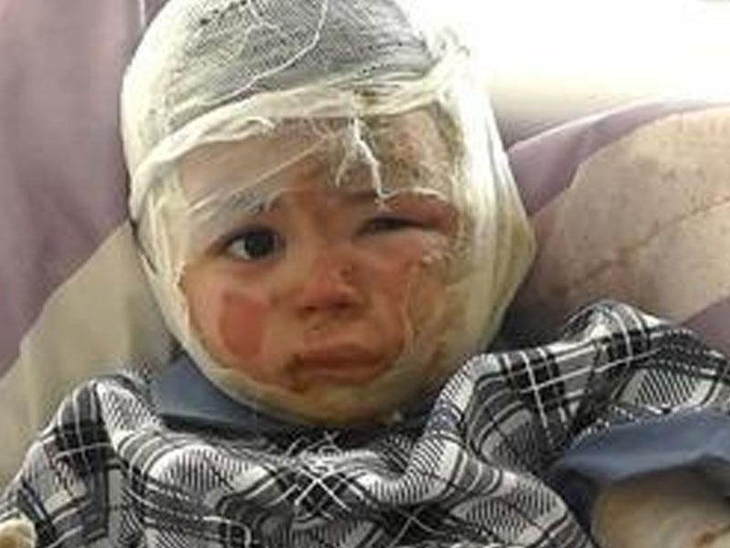 Borca görə azərbaycanlının iki yaşlı övladı yandırıldı