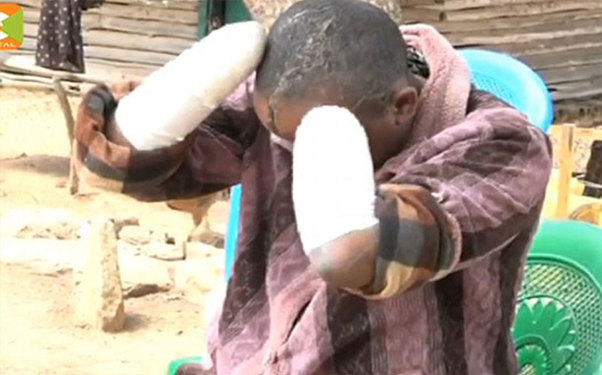 Uşağı olmur deyə arvadının iki əlini də kəsdi