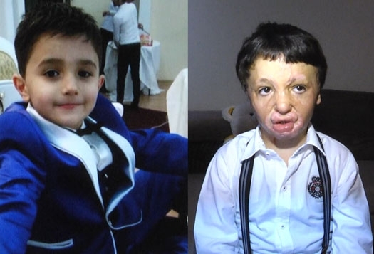 Leyla Əliyevanın xilas etdiyi 6 yaşlı Rəvan