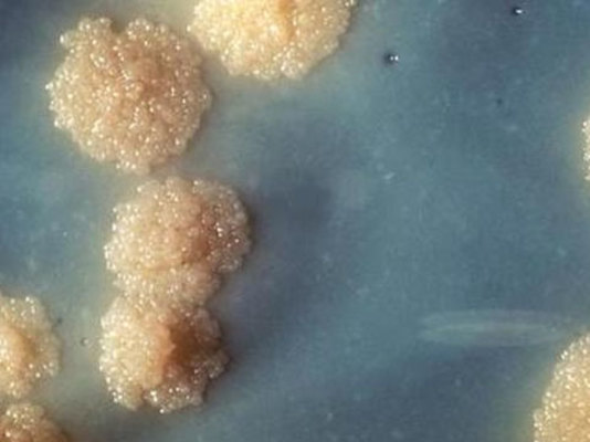 Vərəmdən qorunmağın yolları və