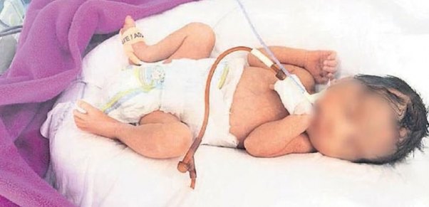 Həkimlər doğuş üçün tezdi dedilər, qız tualetdə ana oldu