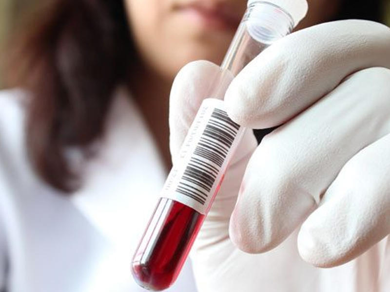 Ermənistanda “donuz qripi” epidemiyası