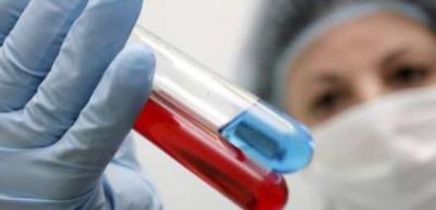 Azərbaycanda “donuz qripi” təhlükəsi