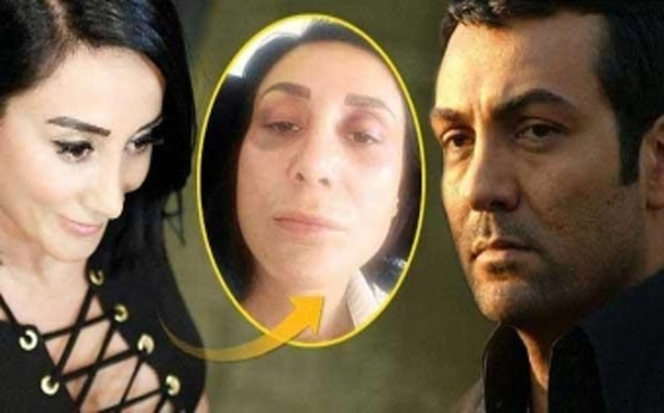 Sevgilisini 200 minə görə döyübmüş