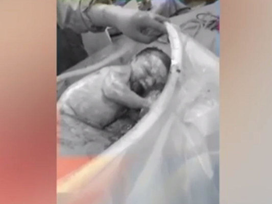 Dünya anasının qarnından özü çıxan bu körpədən danışır