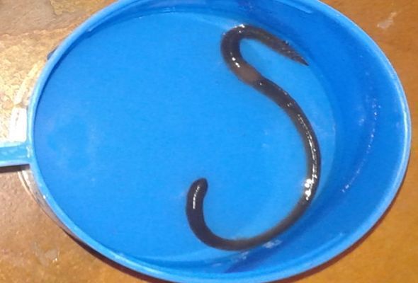 Məktəblinin mədəsində 18 santimetrlik soxulcan çıxdı