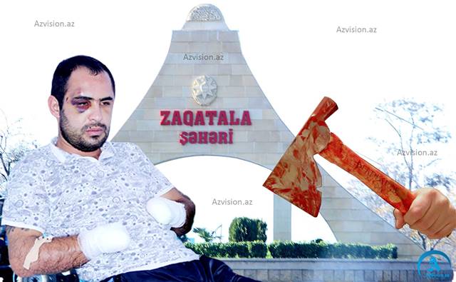 `Yalvardım ki, qolumu kəsməyin...`