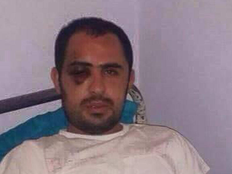 Borca görə əlləri kəsilən şəxsin