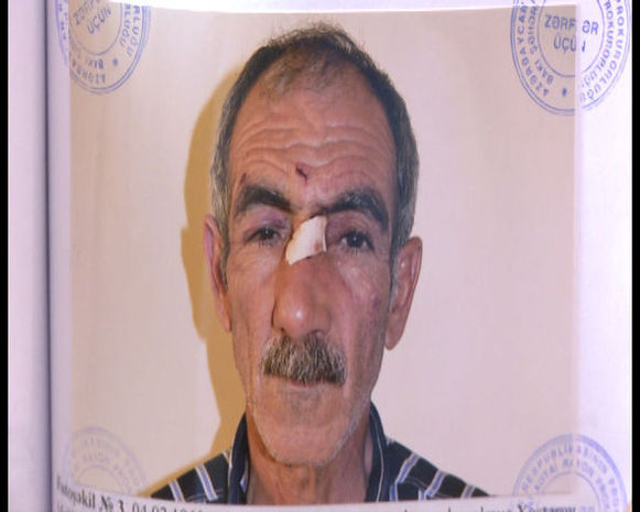 Həbsxana yoldaşını öldürüb, şalvarını çıxaran ağdamlıya hökm oxundu