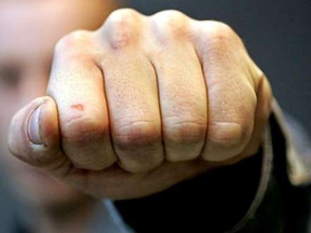 Binəqədinin icra nümayəndəsi döyüldü