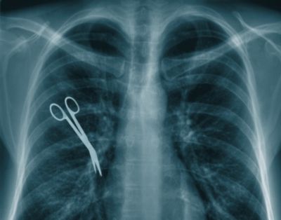 Həkimlərin dəhşətli səhvi 5 il sonra üzə çıxdı