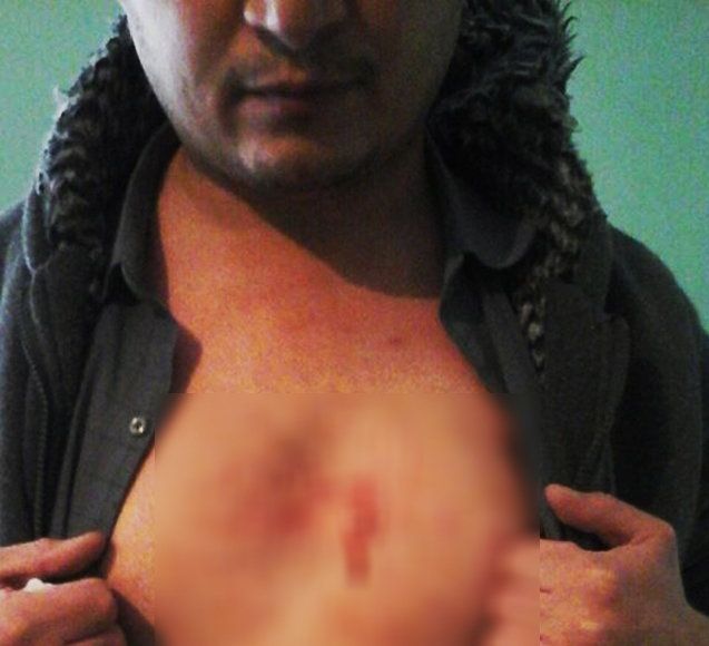 “Polislər məni döydü, - rəis isə şantaj edir...”