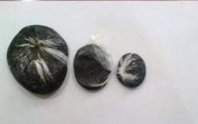 Bağırsağında narkotik vasitə keçirmək istədi