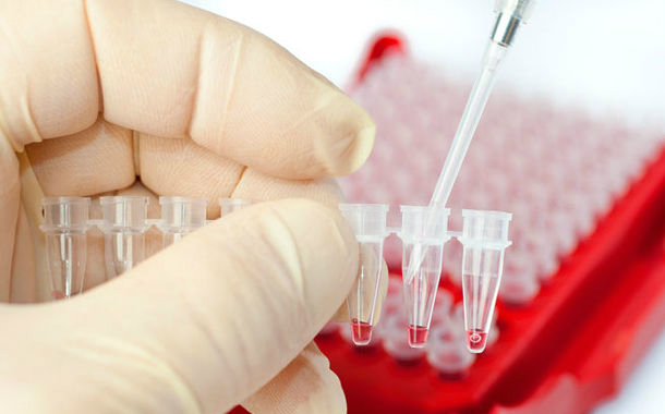 Azərbaycanda evlənmək istəyən 161 nəfərdə sifilis aşkarlandı