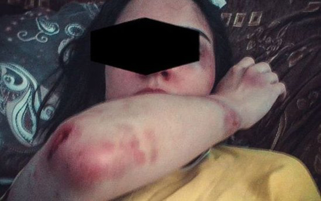 Arvadını ütü ilə yandırıb işgəncə verən kişi həbs edildi