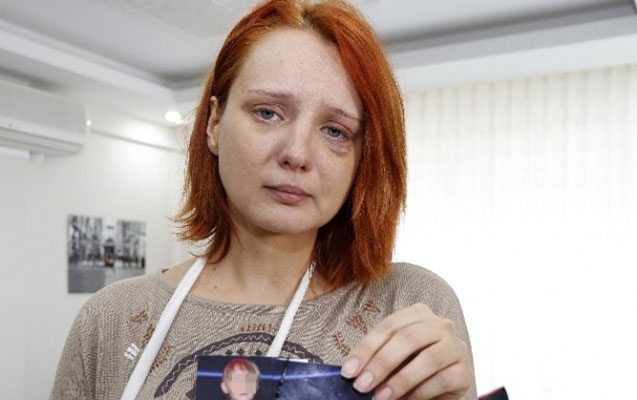 Əri azərbaycanlı qadını döyərək bu hala saldı