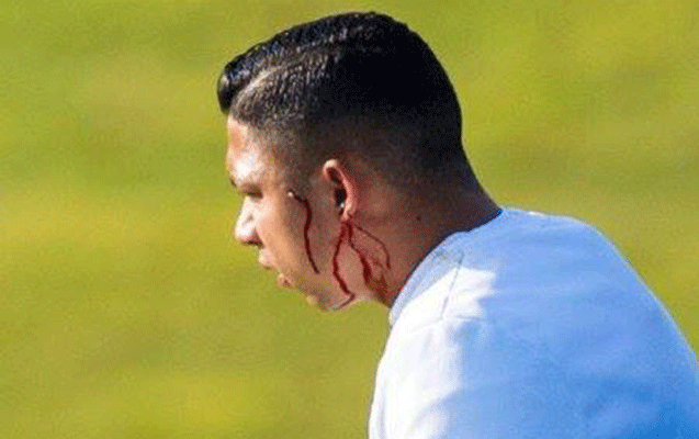 Türk futbolçu komanda yoldaşını qana boyadı