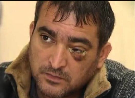 Dostunu bıçaqlayan şəxs: Kimə xoş olar bu hal?!