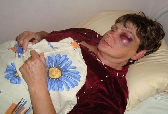 Bakıda 11-ci sinif şagirdi qadın müəllimini qana boyadı