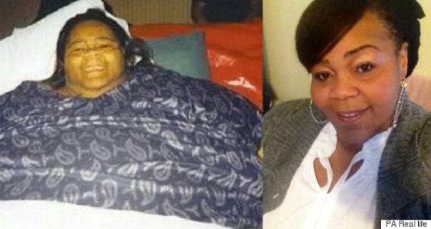 Dünyanın ən kök qadını 230 kq arıqladı