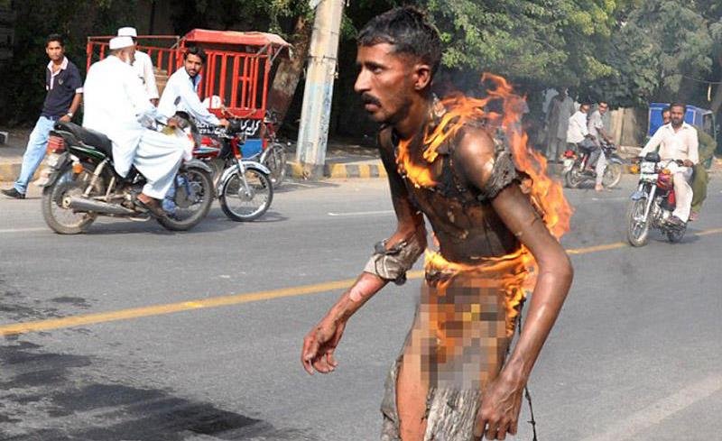 Məmurlardan bezən Əhməd özünü yandırdı