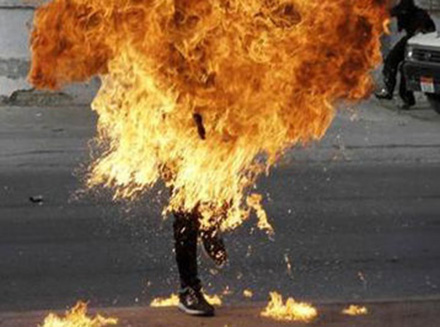 Bakıda ata olmağa hazırlaşan şəxs özünü yandırdı