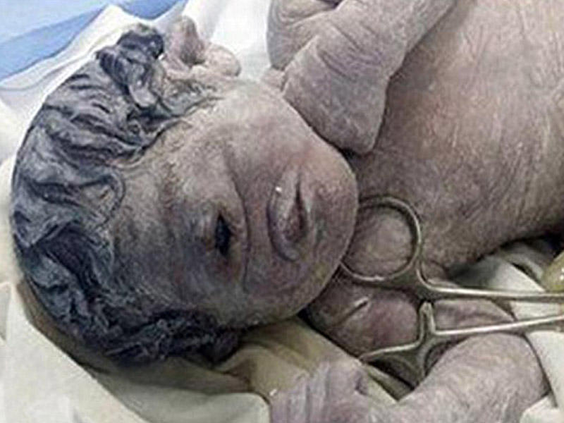 Misirdə təpəğöz uçaq doğuldu