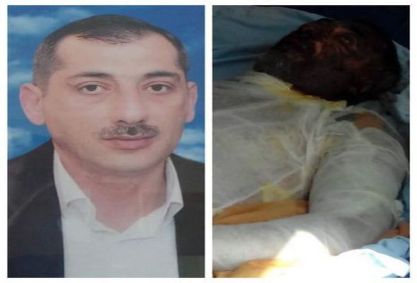 Qarabağ döyüşçüsü ANS-in həyətində niyə özünü yandırdı?