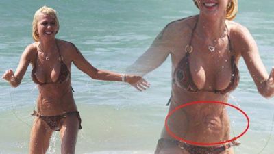 Uğursuz plastik əməliyyat aktrisanı bu hala saldı