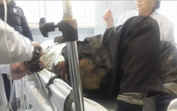 41 yaşlı kişi özünü küçədə yandırdı