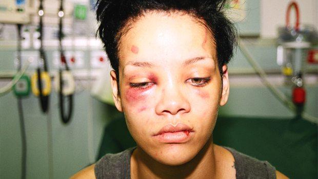 Rihannanı döydüyü üçün qadağa: 