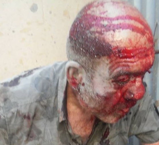 Ermənistanda müharibə veteranını döydülər