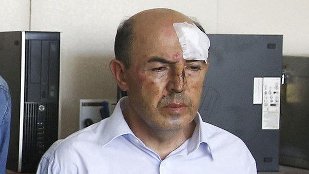 Türkiyədə daha bir general saxlanıldı