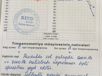 “KİND SƏS” EŞİTMƏ MƏRKƏZİNDƏ FIRILDAQ