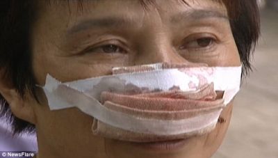 Həyat yoldaşının burnunu qoparıb yedi -